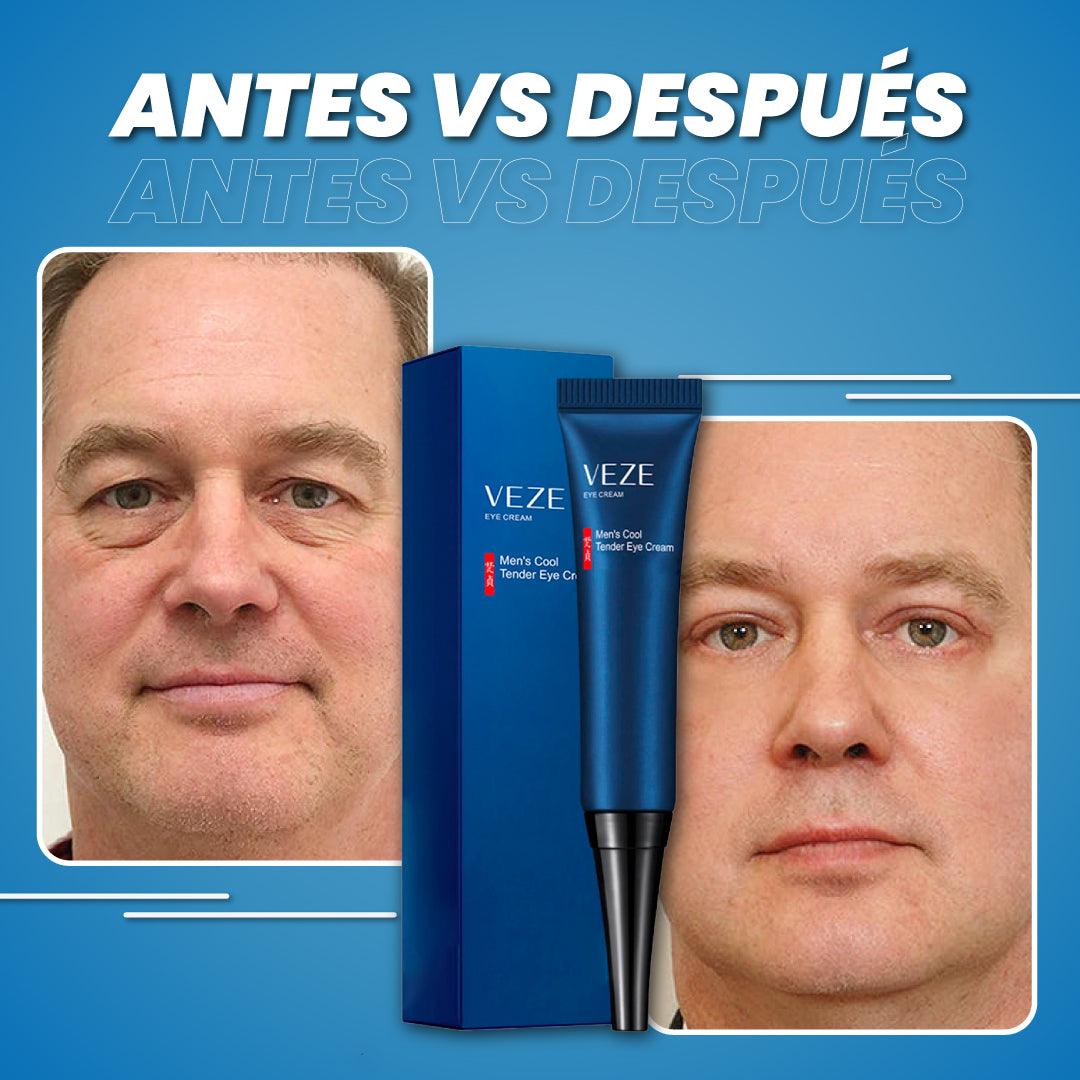 Crema reparadora anti-ojeras - Eye Repair™