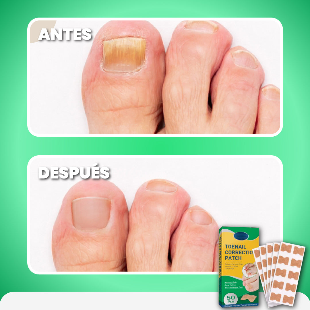 Set de 50 Parches para uñas saludables - Nail Patches™