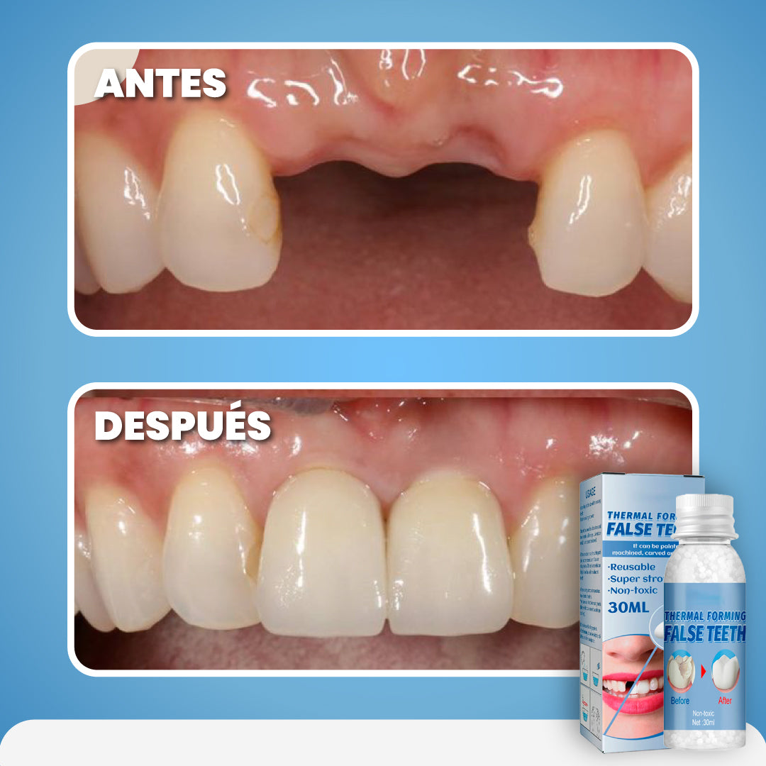 Reparador instantáneo para dientes + 1 Gratis - Smile Fix™