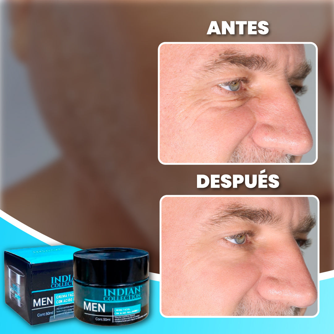 Crema antiarrugas para hombres - Man Glow™