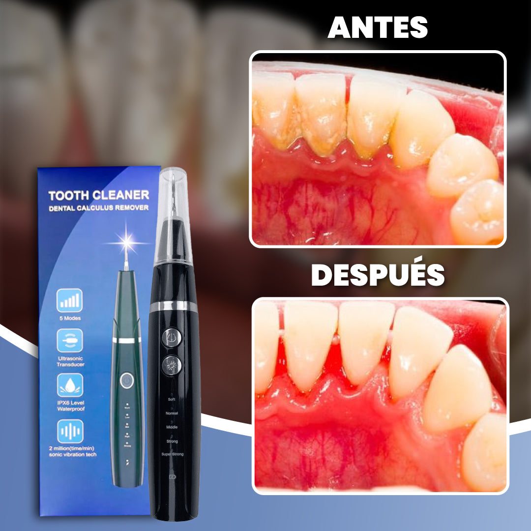 Limpiador ultrasónico de sarro - ProDent™
