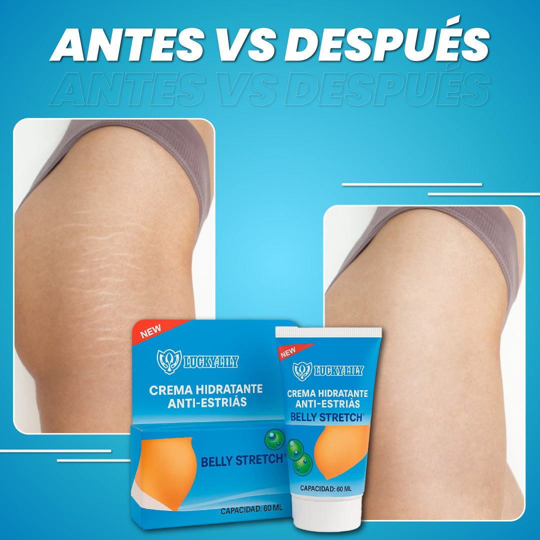 Crema hidratante anti-estrías + Gel reafirmante GRATIS - Belly Stretch™