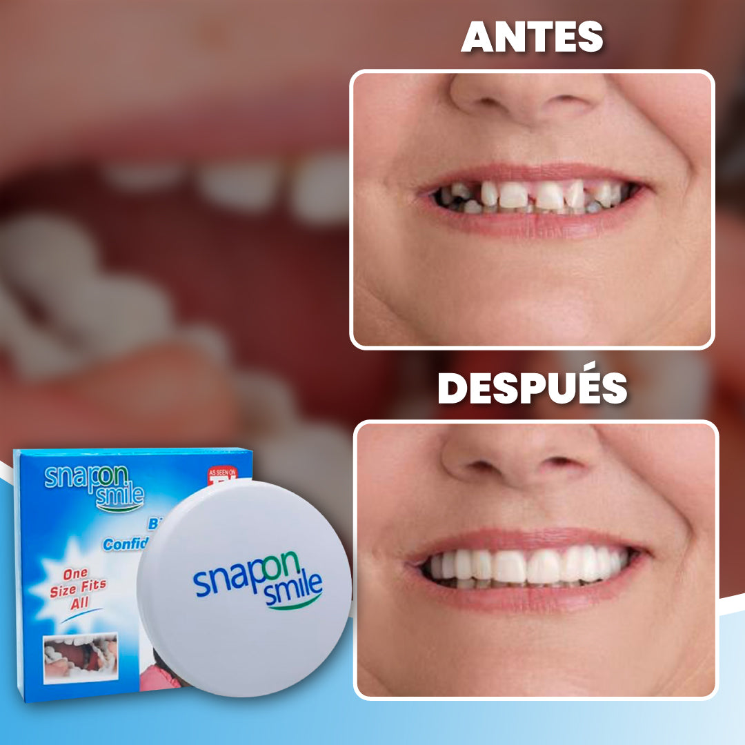 Carillas ajustables para sonrisa perfecta + 1 GRATIS - Smile Flex™