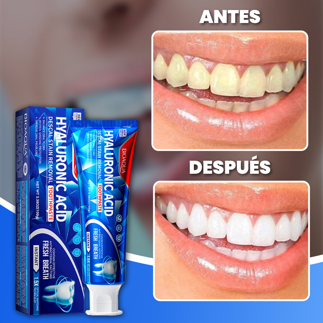 Pasta dental blanqueadora con ácido hialurónico + 1 GRATIS - ProSmile™
