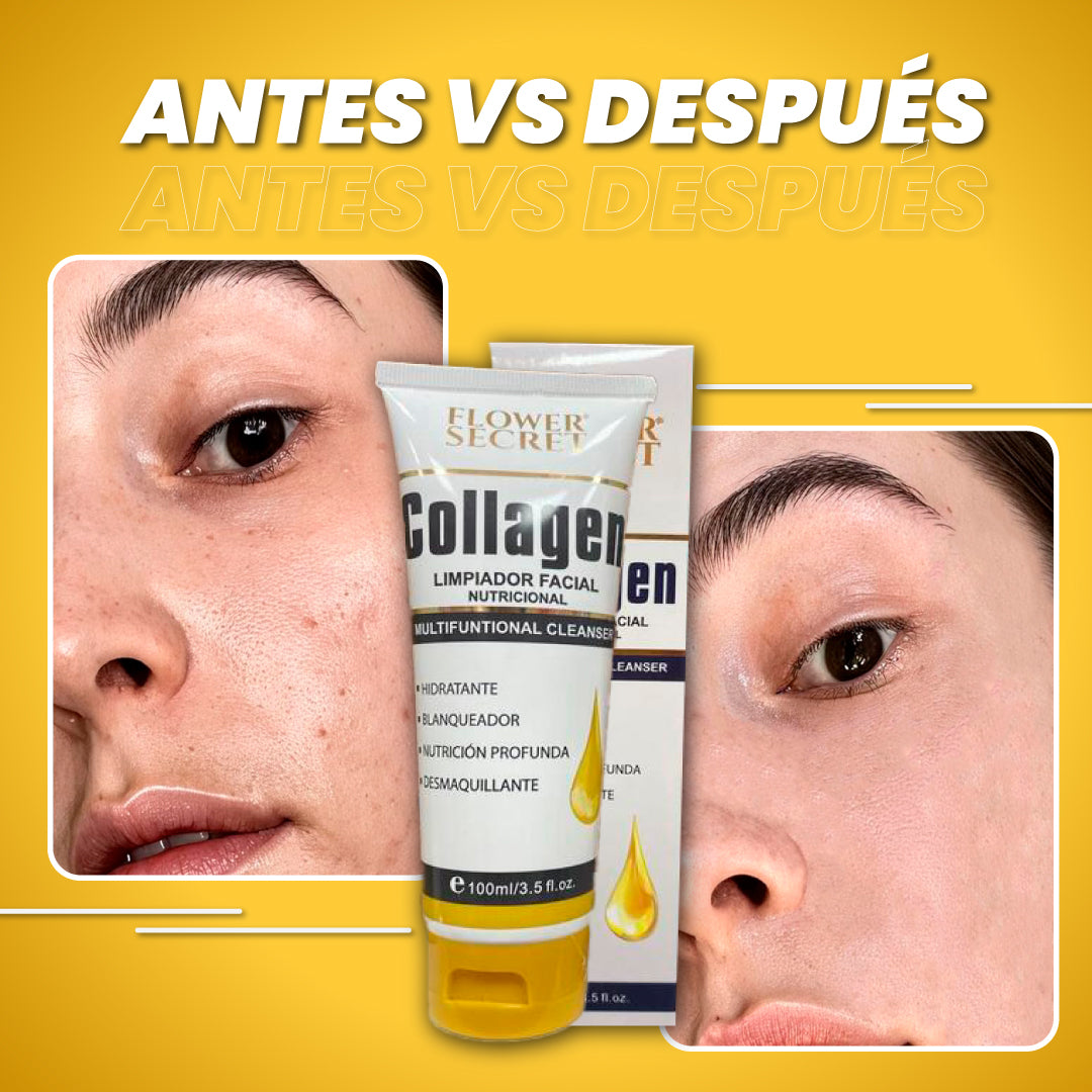 Limpiador facial anti-imperfecciones - WhiteGlow™