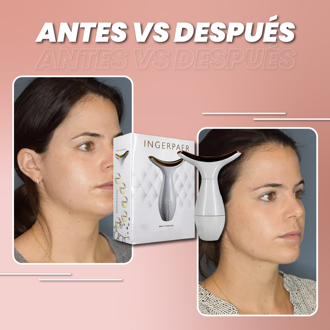 Removedor de arrugas y papada - Lift Ingerpaer™