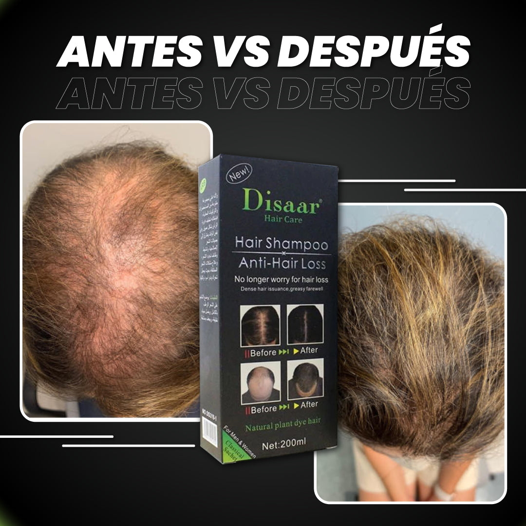 Shampoo para hacer crecer tu cabello - Hair Loss™