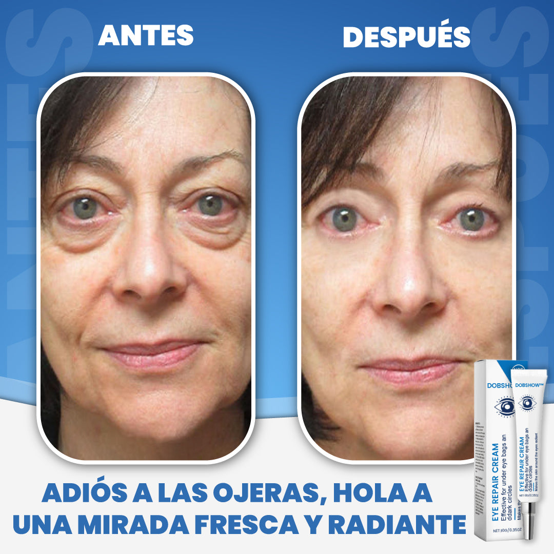 Crema revitalizante para contorno de ojos - Eye Revive™