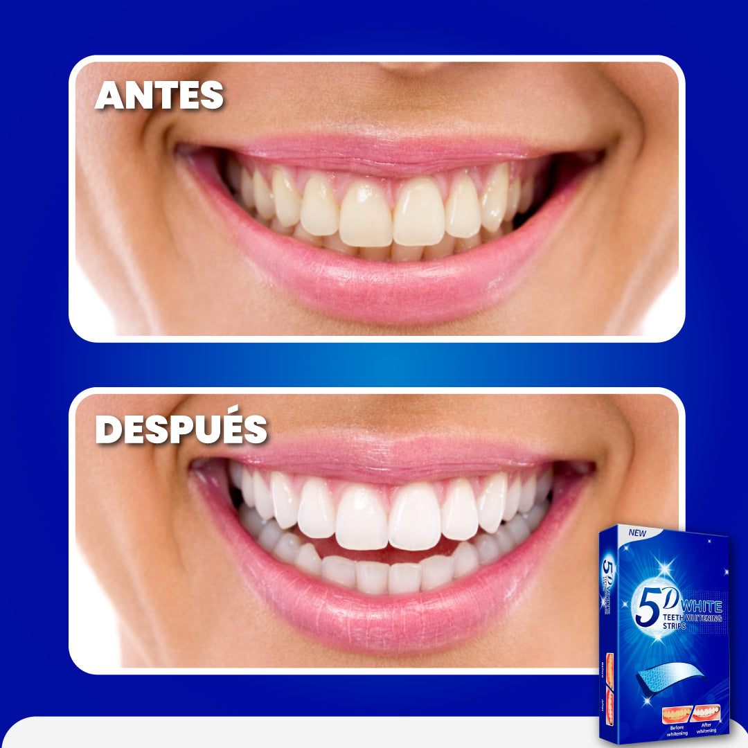 Bandas para blanqueamiento dental inmediato - Dental Whitening™