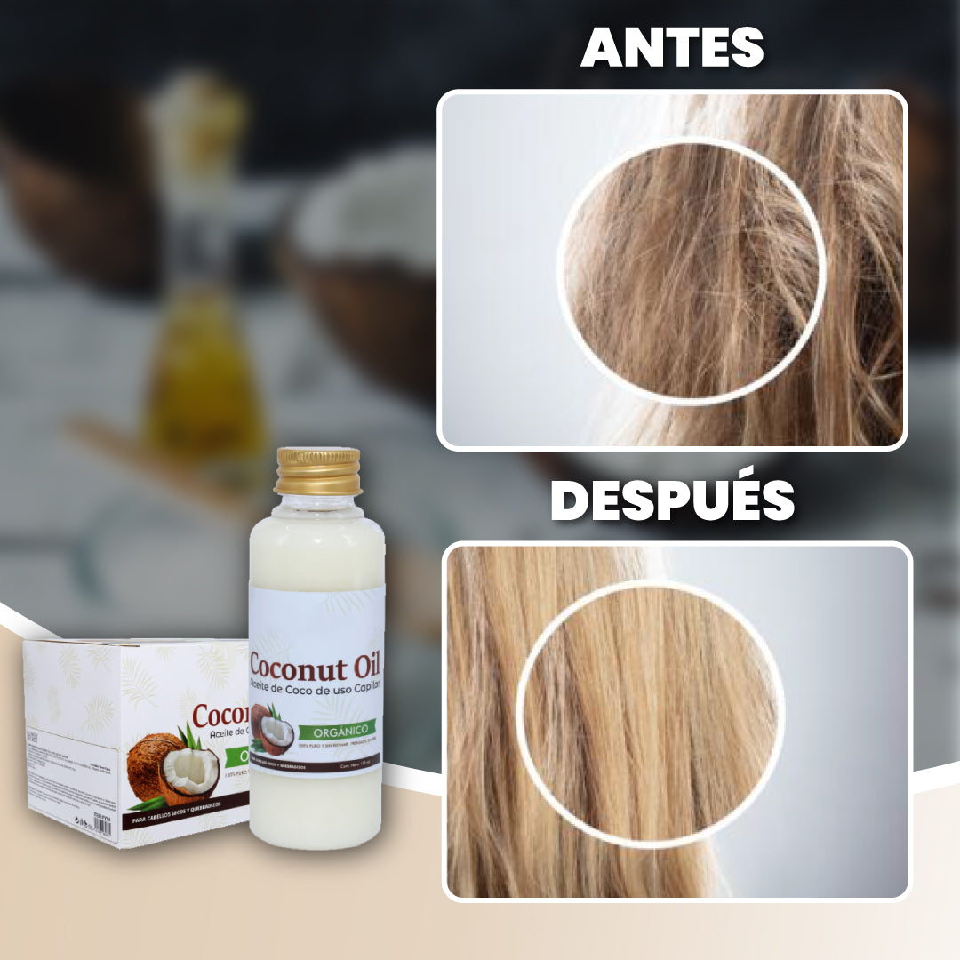 Aceite de coco para revitalizar tu cabello - Coconut™