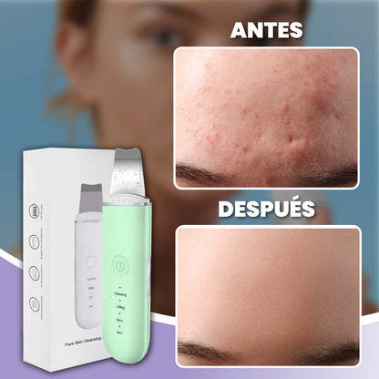 Limpiador facial ultrasónico de impurezas - Sonic Glow™