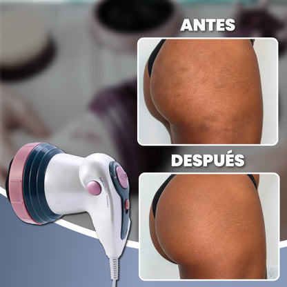 Masajeador anticelulitis 4 en 1 - Massager Pro™