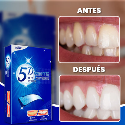 Bandas para blanqueamiento dental inmediato - Dental Whitening™