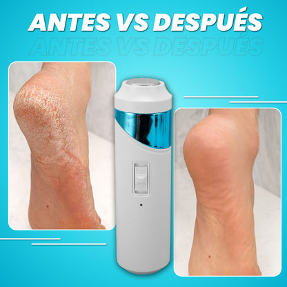 Lima eléctrica para callos y durezas  – Feet Pro™