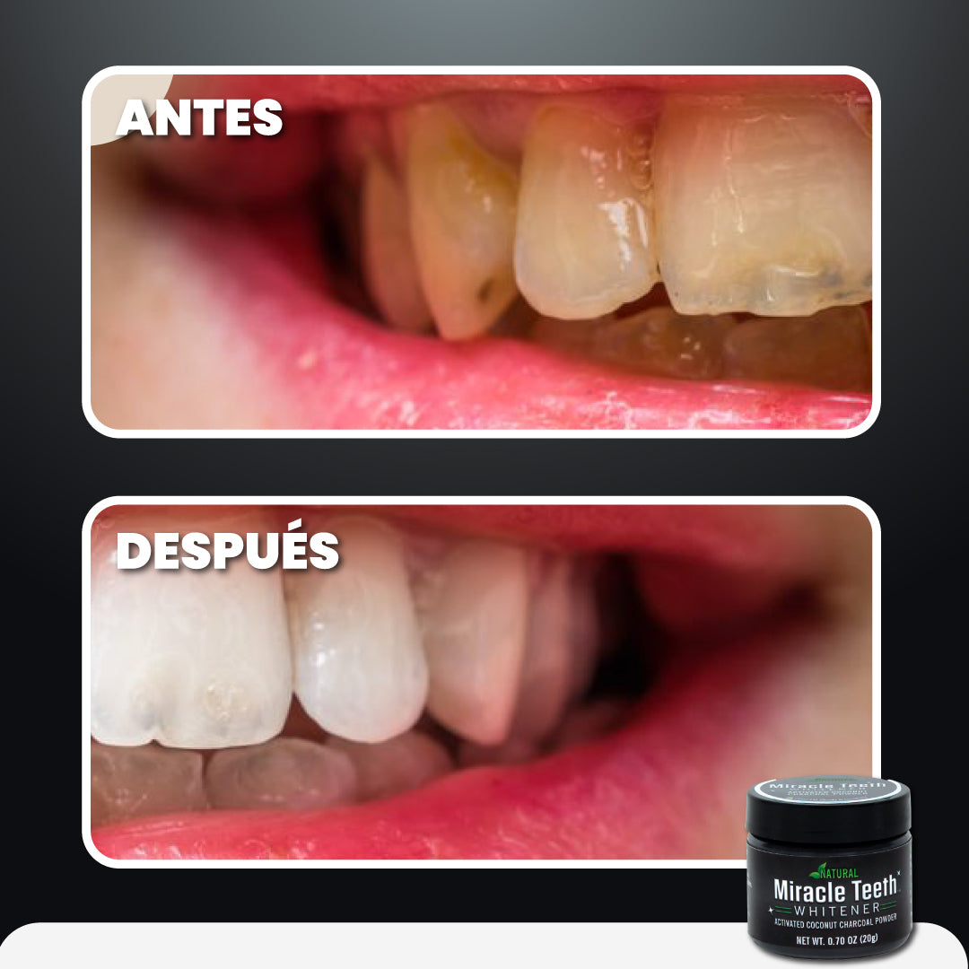 Pasta de dientes blanqueadora y antibacteriana - Miracle Teeth™