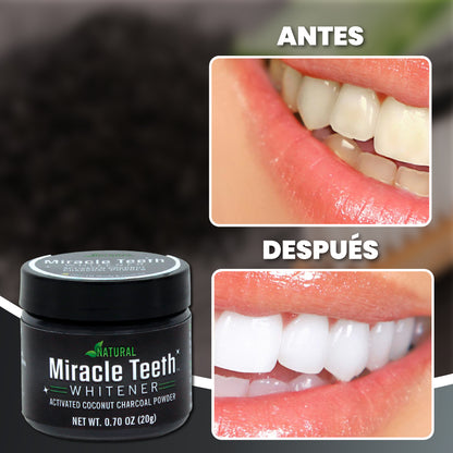 Pasta de dientes blanqueadora y antibacteriana - Miracle Teeth™