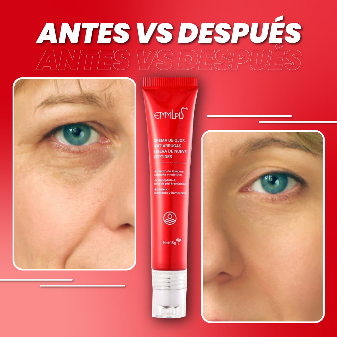 Crema anti ojeras y bolsas oscuras - Eyes Remove™