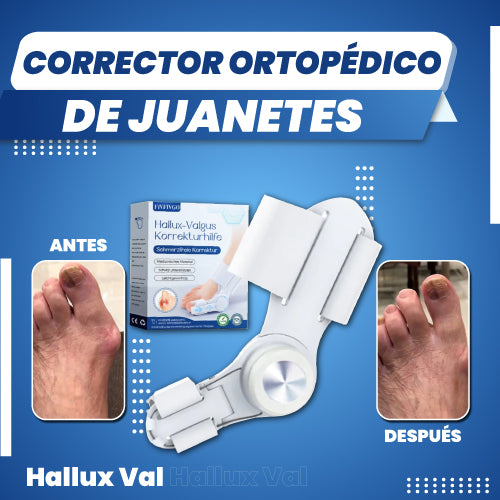 Corrector ortopédico de juanetes - Hallux Val™