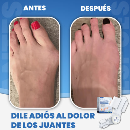 Corrector ortopédico de juanetes - Hallux Val™