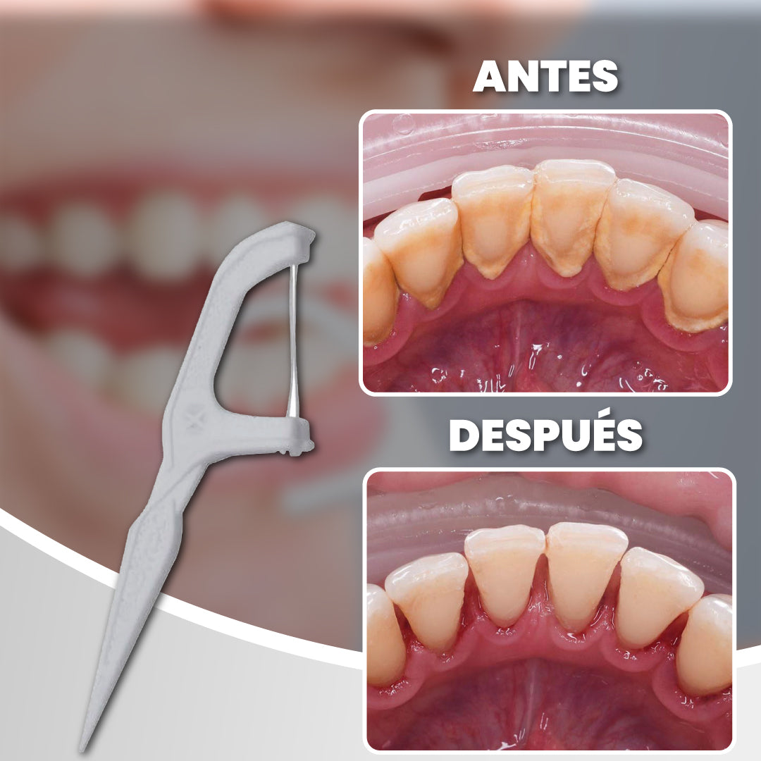 Pack de 150 hilos dentales anti-bacterias - Fresh Clean™