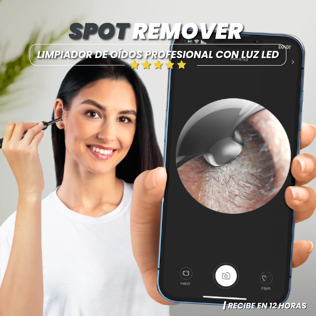 Limpiador de oídos profesional con luz led- Spot Remover™