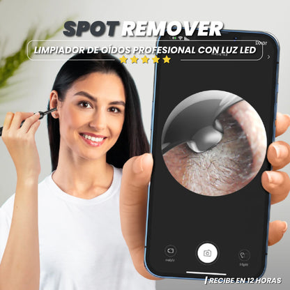 Limpiador de oídos profesional con luz led- Spot Remover™