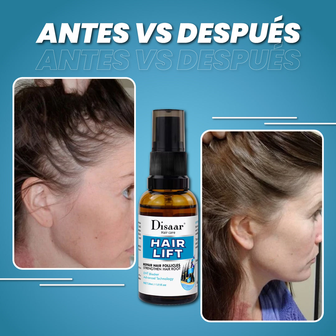 Spray para crecimiento capilar - Hair Lift™