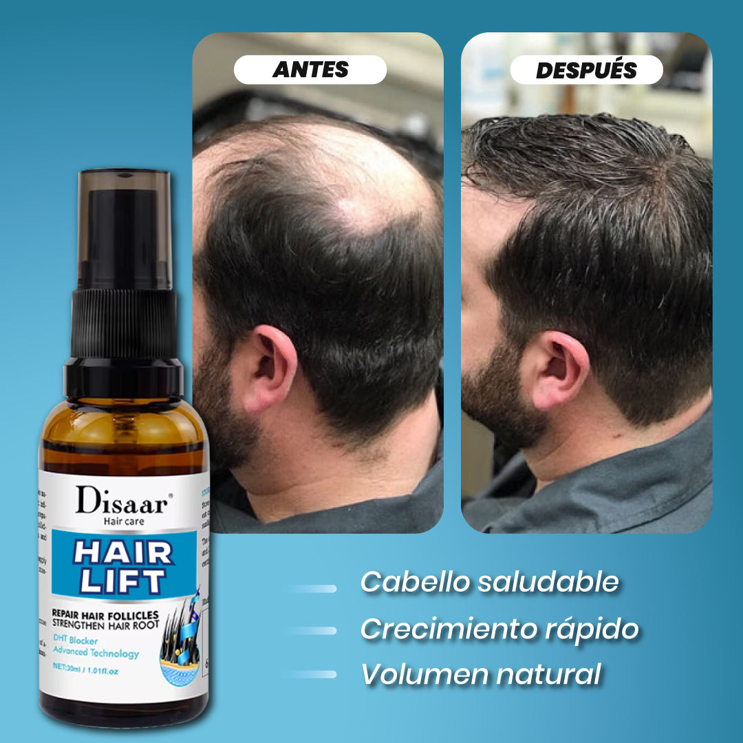 Spray para crecimiento capilar - Hair Lift™